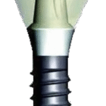 scidmos implant + crown